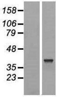 Western Blot: TRIM16L [C-terminal Myc/DDK*] Lysate [NBL1-17279] - Western Blot experiments. Left-Control; Right -Over-expression Lysate